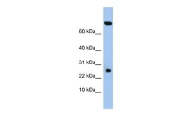 Anti-ZSWIM3 antibody, N-term used in Western Blot (WB). GTX45506