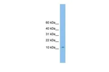 Anti-CHCHD1 antibody, Internal used in Western Blot (WB). GTX45515