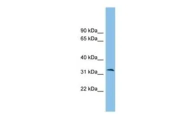 Anti-ZPBP2 antibody, Internal used in Western Blot (WB). GTX45518