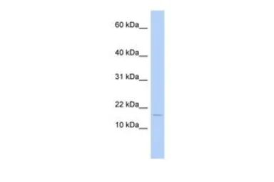 Anti-ISCA2 antibody, Internal used in Western Blot (WB). GTX45528