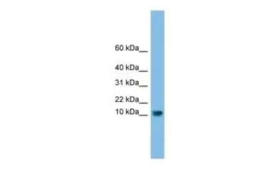 Anti-C13orf30 antibody, N-term used in Western Blot (WB). GTX45533