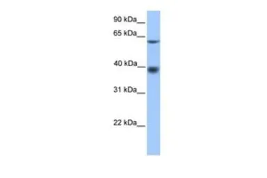 Anti-MFSD4 antibody, N-term used in Western Blot (WB). GTX45538