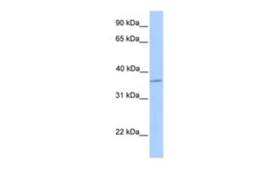 Anti-Layilin antibody, N-term used in Western Blot (WB). GTX45539