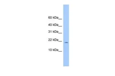 Anti-C10ORF83 antibody, Internal used in Western Blot (WB). GTX45541