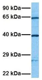 Anti-2'-PDE antibody, Internal used in Western Blot (WB). GTX45550