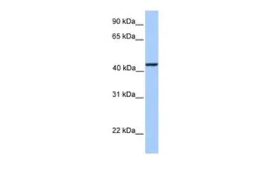 Anti-KLC3 antibody, Internal used in Western Blot (WB). GTX45552