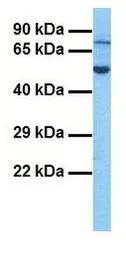 Anti-EXOC8 antibody, N-term used in Western Blot (WB). GTX45557