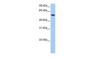 Anti-C18orf54 antibody, Internal used in Western Blot (WB). GTX45571