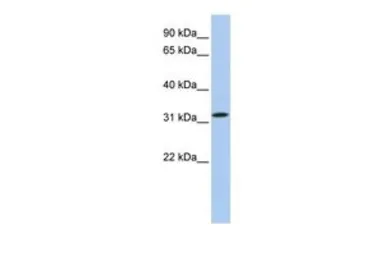 Anti-C15ORF26 antibody, C-term used in Western Blot (WB). GTX45572