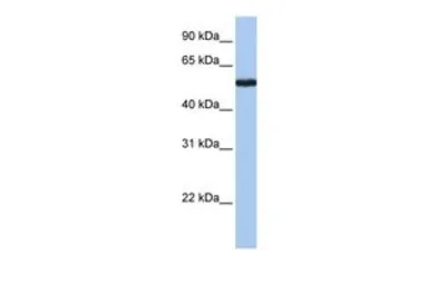 Anti-FLJ90709 antibody, Internal used in Western Blot (WB). GTX45575