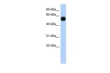 Anti-MPP7 antibody, N-term used in Western Blot (WB). GTX45577