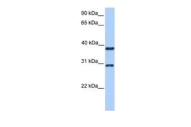 Anti-KLHDC1 antibody, N-term used in Western Blot (WB). GTX45587