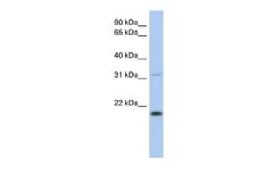 Anti-CLECL1 antibody, Internal used in Western Blot (WB). GTX45589