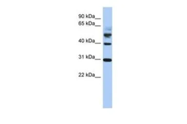 Anti-TTL antibody, Internal used in Western Blot (WB). GTX45596