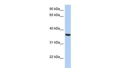Anti-PSTK antibody, Internal used in Western Blot (WB). GTX45610