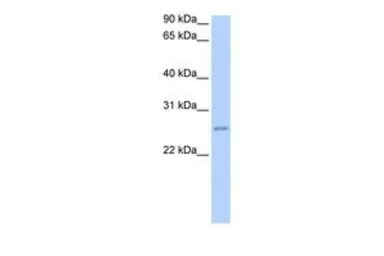 Anti-RPESP antibody, C-term used in Western Blot (WB). GTX45616