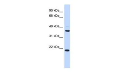 Anti-TMEM74 antibody, Internal used in Western Blot (WB). GTX45618