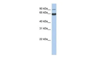 Anti-CCDC128 antibody, N-term used in Western Blot (WB). GTX45622