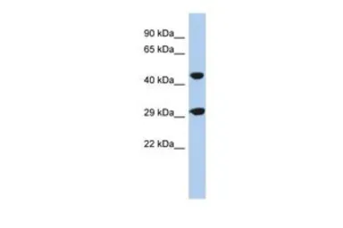 Anti-C22ORF25 antibody, N-term used in Western Blot (WB). GTX45623