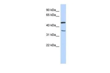 Anti-FAM81B antibody, N-term used in Western Blot (WB). GTX45644
