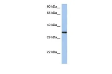 Anti-HORMAD2 antibody, N-term used in Western Blot (WB). GTX45650