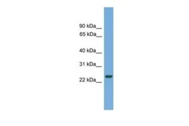 Anti-C19orf18 antibody, N-term used in Western Blot (WB). GTX45651