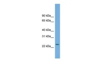 Anti-C5ORF24 antibody, Internal used in Western Blot (WB). GTX45660