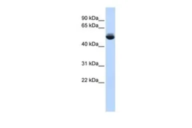 Anti-TRAM1L1 antibody, Internal used in Western Blot (WB). GTX45662