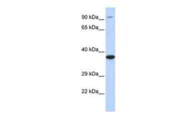 Anti-BBS5 antibody, Internal used in Western Blot (WB). GTX45664