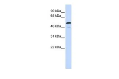 Anti-SPATA2L antibody, Internal used in Western Blot (WB). GTX45672
