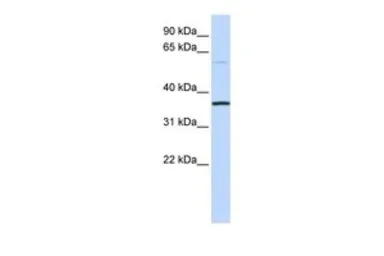 Anti-C16ORF46 antibody, N-term used in Western Blot (WB). GTX45674