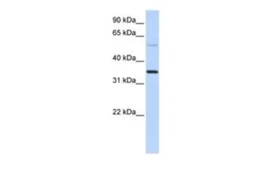 Anti-ANKRD9 antibody, Internal used in Western Blot (WB). GTX45678
