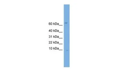Anti-OTOS antibody, N-term used in Western Blot (WB). GTX45680
