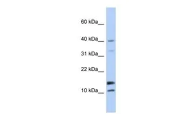 Anti-WFDC5 antibody, N-term used in Western Blot (WB). GTX45684