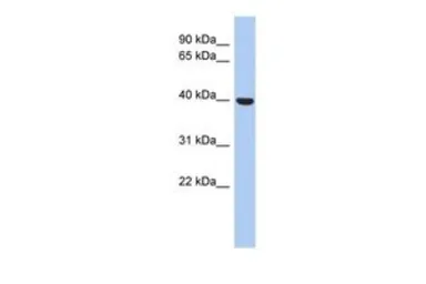 Anti-STOML3 antibody, N-term used in Western Blot (WB). GTX45686