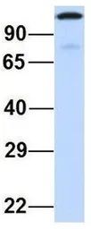 Anti-CCDC52 antibody, Internal used in Western Blot (WB). GTX45708