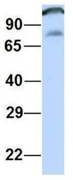 Anti-CCDC52 antibody, Internal used in Western Blot (WB). GTX45708