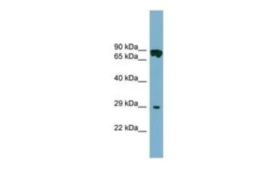 Anti-CYB5D1 antibody, Internal used in Western Blot (WB). GTX45722