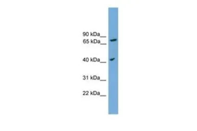 Anti-SPPL3 antibody, Internal used in Western Blot (WB). GTX45727