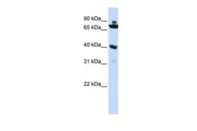 Anti-C7ORF31 antibody, N-term used in Western Blot (WB). GTX45728
