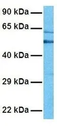 Anti-C6ORF150 antibody, Internal used in Western Blot (WB). GTX45743