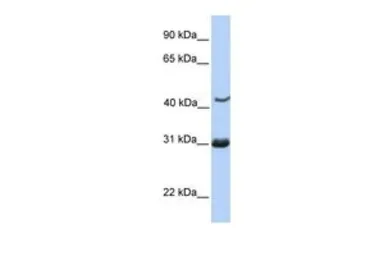 Anti-Nup53 antibody, C-term used in Western Blot (WB). GTX45750