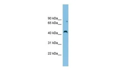 Anti-CCBE1 antibody, Internal used in Western Blot (WB). GTX45753