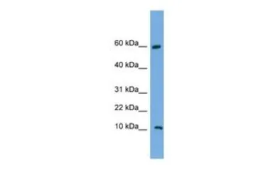 Anti-C20ORF144 antibody, Internal used in Western Blot (WB). GTX45762