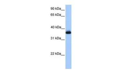 Anti-ERI2 antibody, Internal used in Western Blot (WB). GTX45767