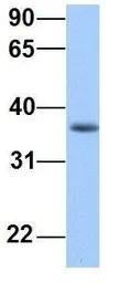 Anti-ERI2 antibody, Internal used in Western Blot (WB). GTX45767