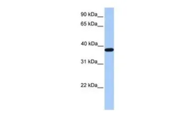 Anti-ACTRT2 antibody, C-term used in Western Blot (WB). GTX45770