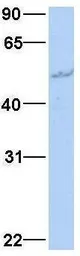 Anti-GLMN antibody, N-term used in Western Blot (WB). GTX45772