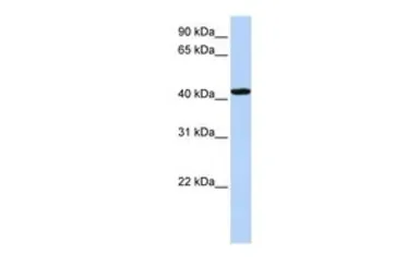 Anti-TADA1L antibody, C-term used in Western Blot (WB). GTX45773