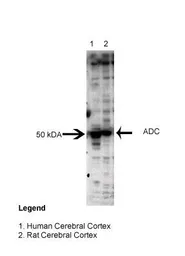 Anti-ADC antibody, Internal used in Western Blot (WB). GTX45774